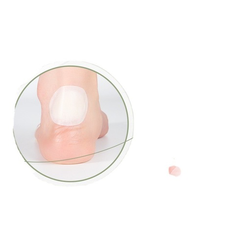 Blister patch watch shaped heel patch summer invisible gel blister patch women's anti-wear heel transparent high heels