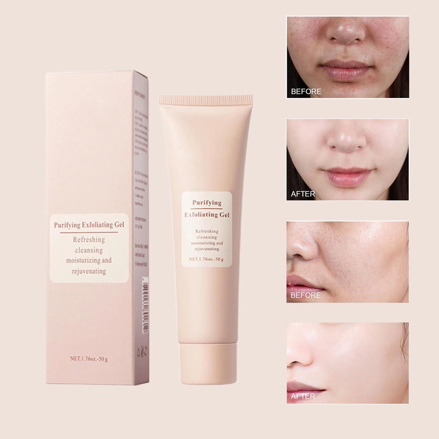 Gel exfoliante especial transfronterizo Gel hidratante limpieza profunda facial exfoliante facial Gel de piel muerta image 6