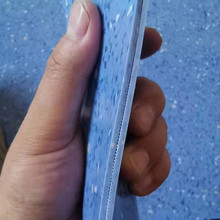 PVCͬ͸޷ذҽԺؽ޻赸ص2MM