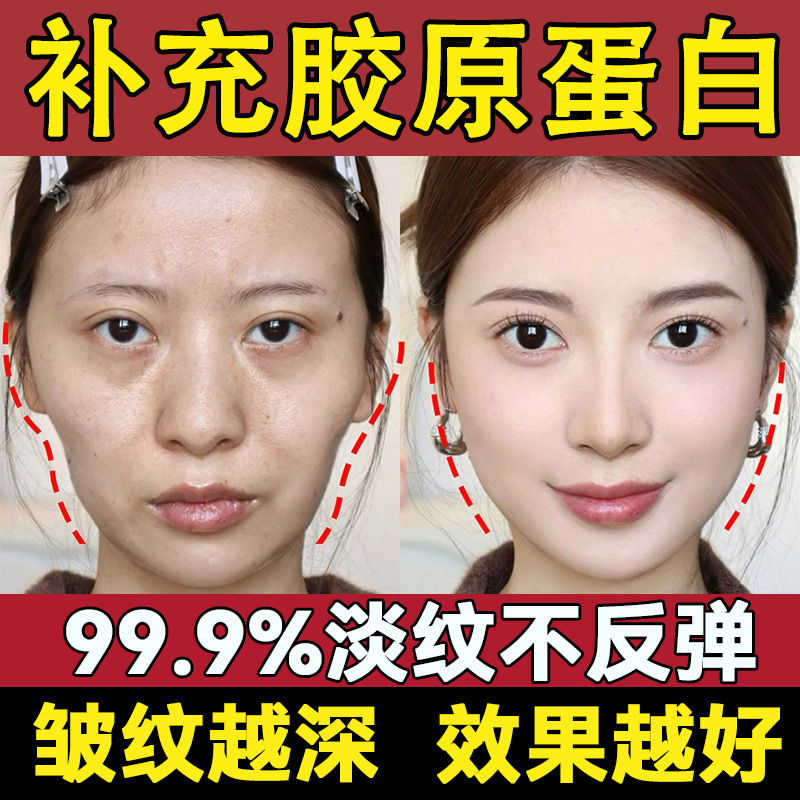 Collagen Filling Cream, Anti-Wrinkle Firming, Nasolabial Fold Removal, Hydrating, Anti-Wrinkle, Rejuvenating, Anti-Aging Restructuring Cream Collagen Filling Cream, Anti-Wrinkle Firming, Nasolabial Fold Removal, Hydrating, Anti-Wrinkle, Rejuvenating, Anti-Aging Restructuring Cream