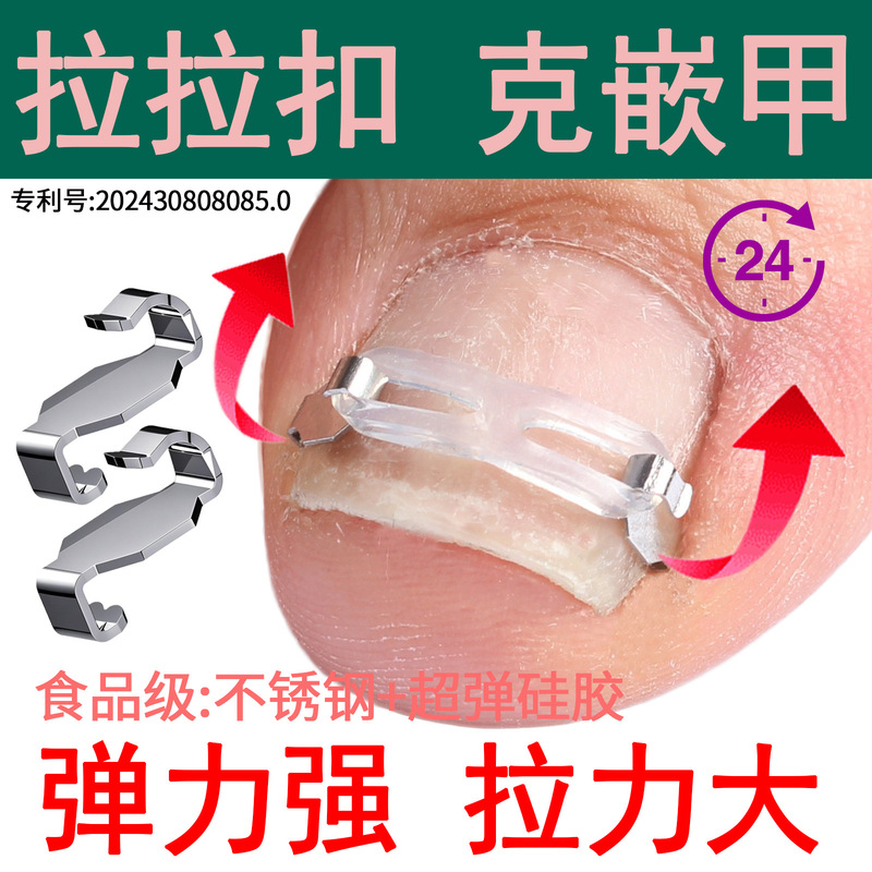 Pull-pull buckle nail groove nail correction nail correction artifact toenail long meat special correction