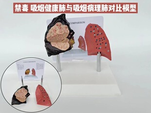 Lung model lung structure mold smoking harm health smoking lung respiratory system pathology lung anatomy model