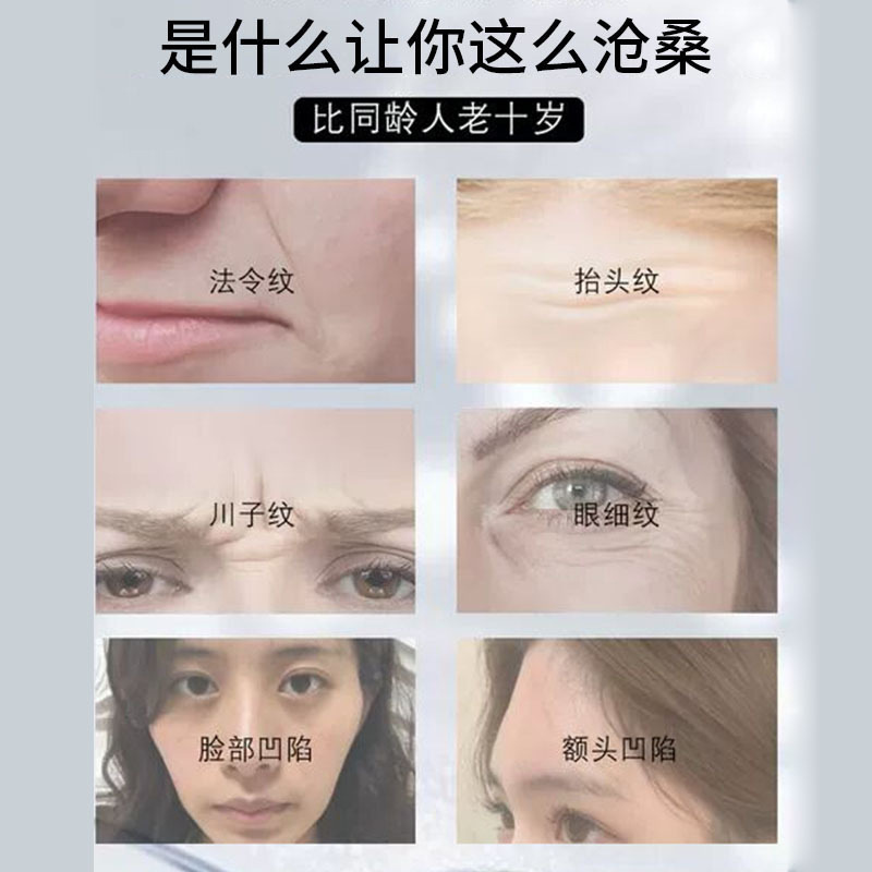 顔のボリュームアップ美容液、太陽穴のボリュームアップ、頬の凹みを埋める、コラーゲンを補充する、しわ取り、引き締め、充填液|undefined