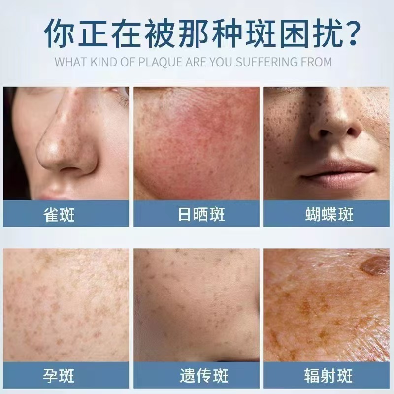 祛斑液排斑液排色液调肤液无尴尬期祛斑原液分解黑色素美容院专供|undefined