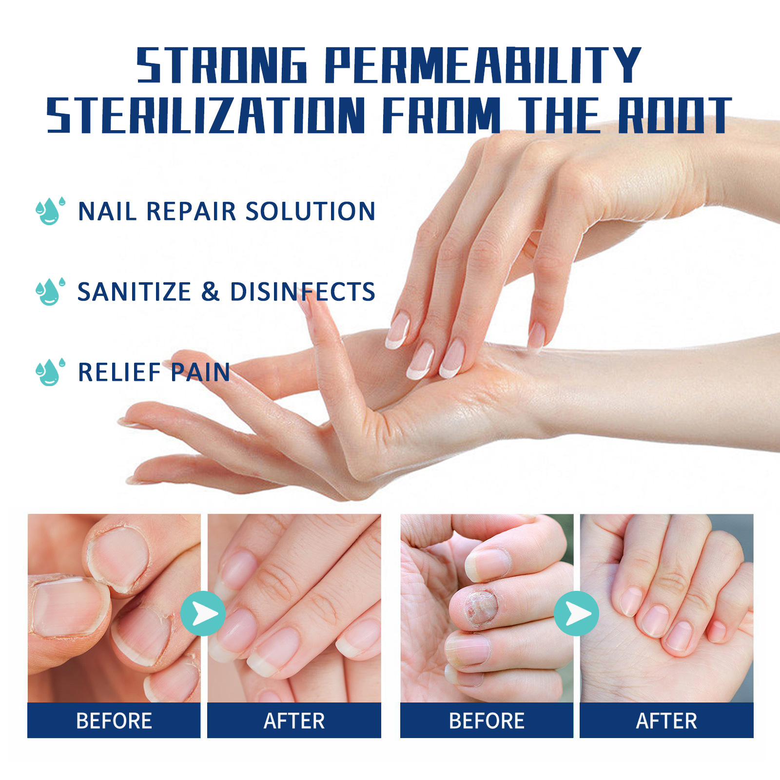 Stylo, ongles gris, ongles épais, doux et brillants, liquide nutritif nettoyant et réparateur de la couche de cuticules_voghion.com