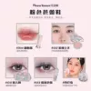 set B