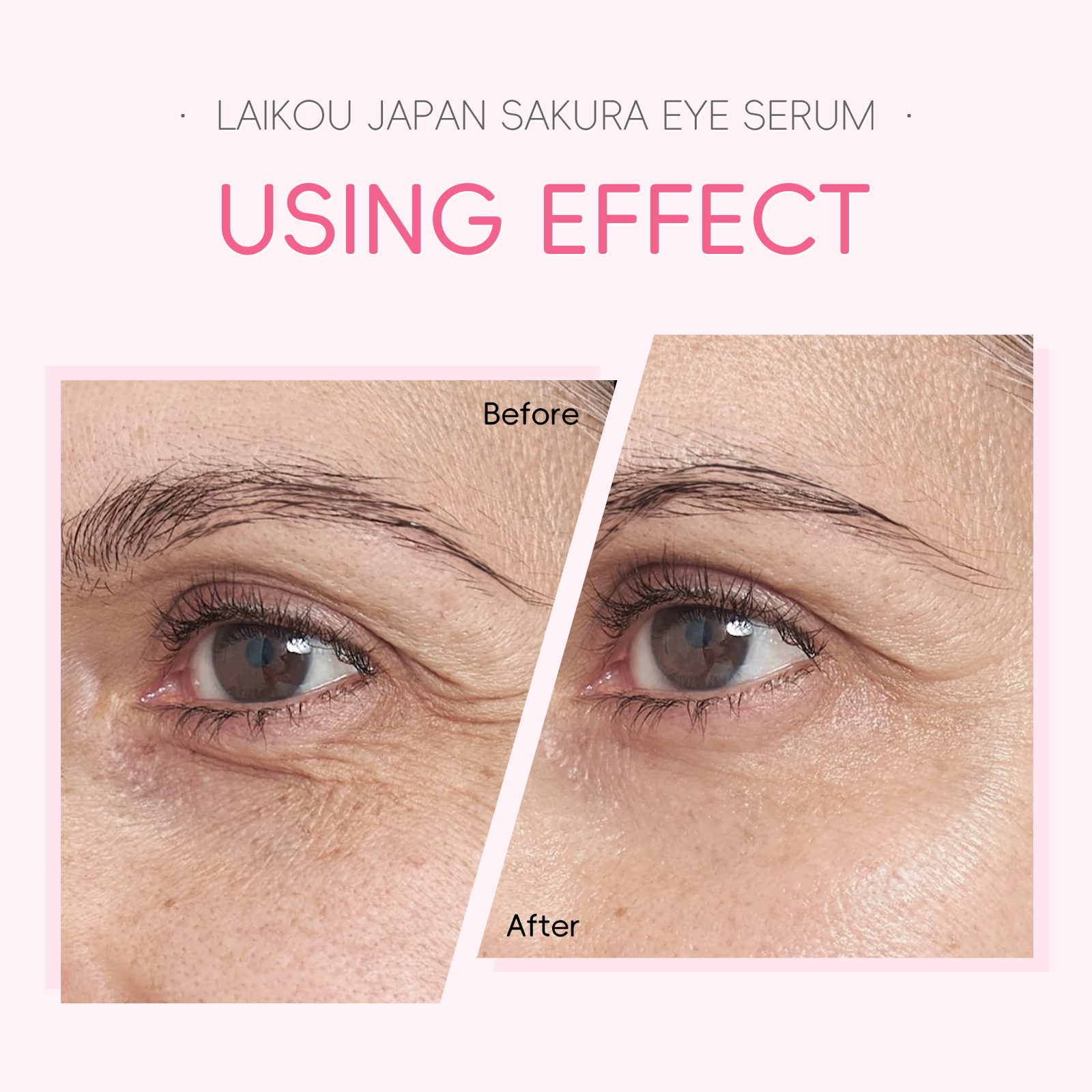 LAIKOU Cherry Blossom Eye Serum 15ml Roll-on Massage Eye Care Cream Moisturizing and Hydrating Skin Care Product undefined