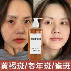 アルブチン原液 美白・ブライトニング・シミ軽減液 色素沈着除去液 肝斑・そばかす 美容サロン用シミ除去液 保湿