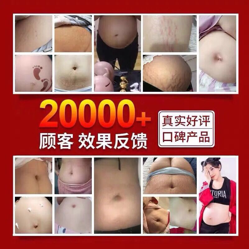 Baicaoshijia's postpartum repair cream for removing fat lines and growing lines for men and women