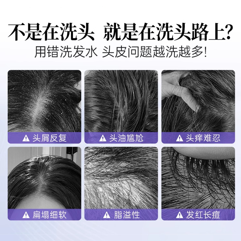 贴牌1%二硫化硒洗发水水杨酸去屑控油止痒蓬松发丝柔顺洗发露批发|undefined