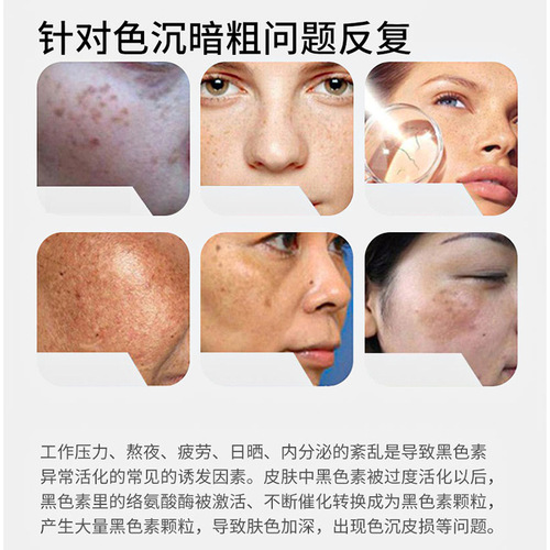 iOEO Tranexamic Acid 5% Essence (Tranexamic Acid) Original Solution Improves Dullness Yellow Crane Brightens Skin Skin Care Products