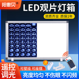 Hospital film viewing light box Medical film viewing light single double triple LED film viewing light box X-ray film viewing light box Orthopedic