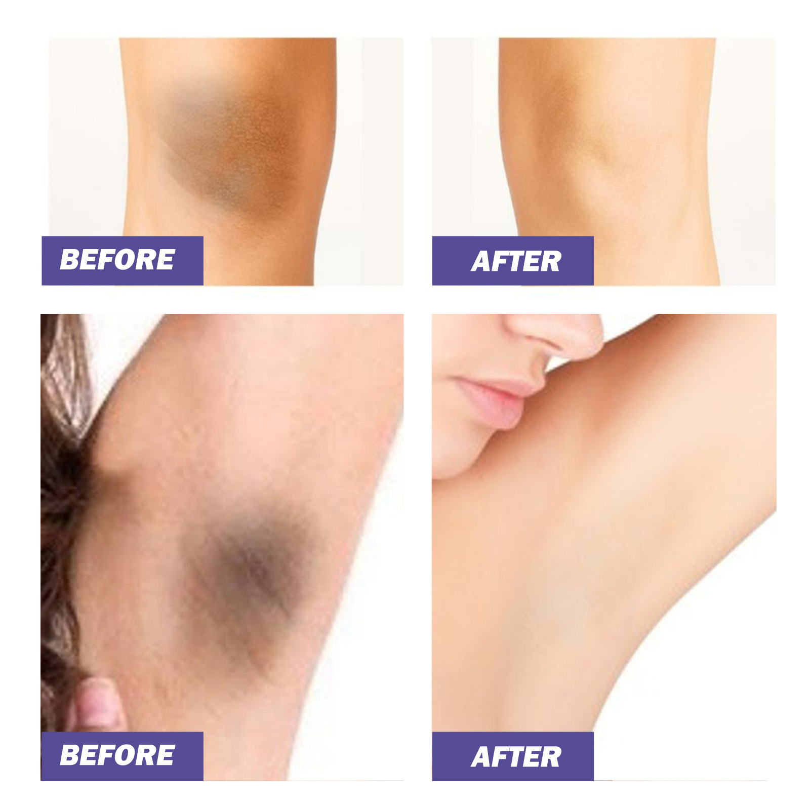 EELHOE whitening cream underarm joint reduces melanin, moisturizes smoothes skin, leaving skin fresh and not g_voghion.com