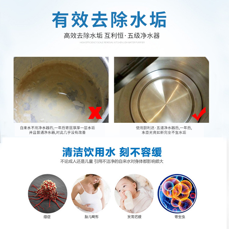 Purificador de agua comercial, máquina de hielo, tienda de té con leche, restaurante, café especial, agua del grifo, prefiltro de ultrafiltración