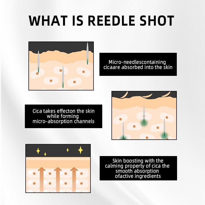 クロスボーダーアロエ保湿ツボクサプロポリスエッセンス CICA REEDLE SHOT 100 スポンジマイクロニードルエッセンス|undefined