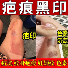 疤痕膏修护疤痕剖腹产增生疤手术疤痕痘印痘坑美容院妊娠纹修护霜