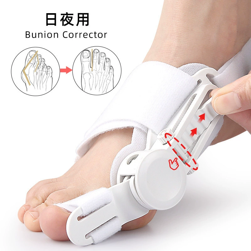 Ортез для вальгусной деформации большого пальца ноги, перекрывающийся разделитель пальцев ног, пряжка, регулируемый ортез