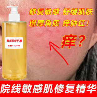 Sensitive Muscle Essence Beauty Salon Repairing Corneal Skin Barrier Improving Redness, Redness, Swelling and Itching Hormone Face Liquid