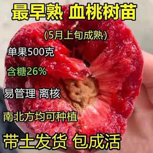 ����Ѫ�Ҙ����Ѫ�Ҙ��������F��Ѫ�Ҽ޽ӷN�Ҙ��箔��Y��