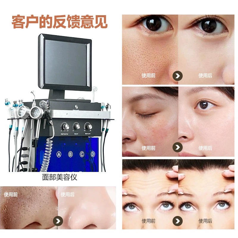 Hafei Beauty Salon multifuncional gestión de la piel cuidado de la piel instrumento integral de burbuja de aire de tamaño de espectáculo instrumento de limpieza de artefactos mágicos