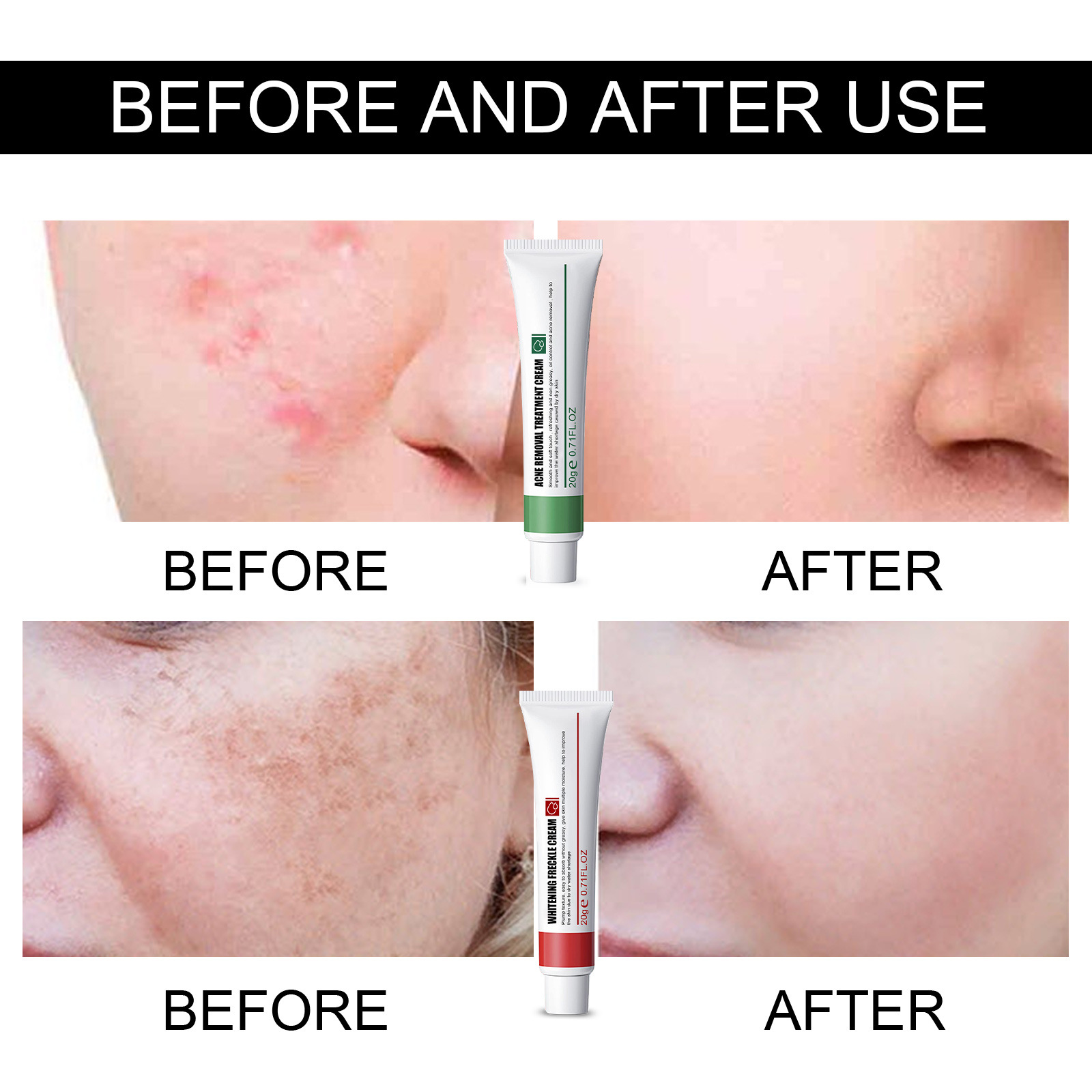 EELHOE traipu noņemšanas krēms izgaismo plankumus, padara toni gaišāku, mitrina ādu, pūtīšu un plankumu ādas kopšanai_voghion.com