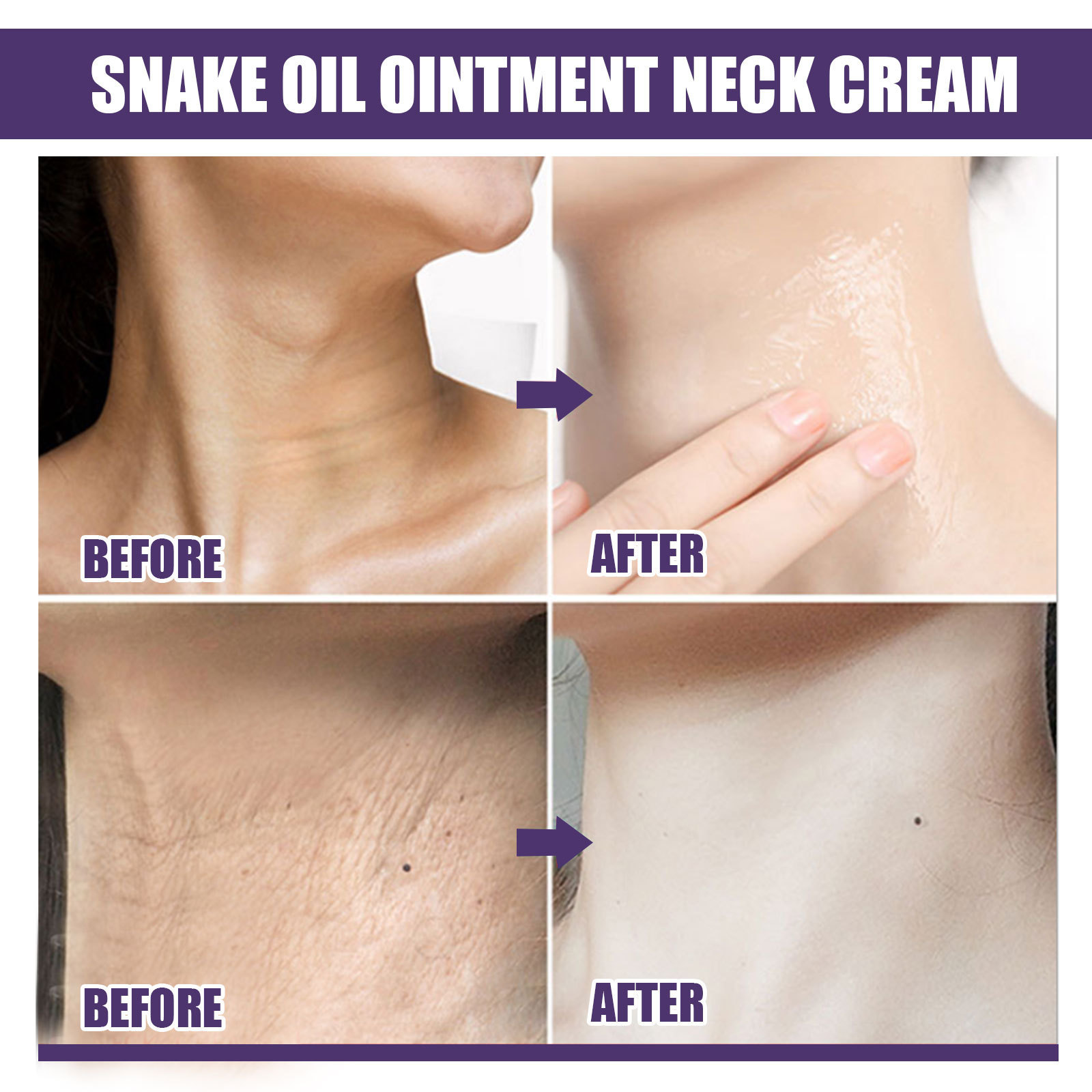 EELHOE Snake Oil Lightens Smoothens Wrinkles Lifting, Firming, Smoothing, Whitening, and Moisturizing Neck Cream_voghion.com