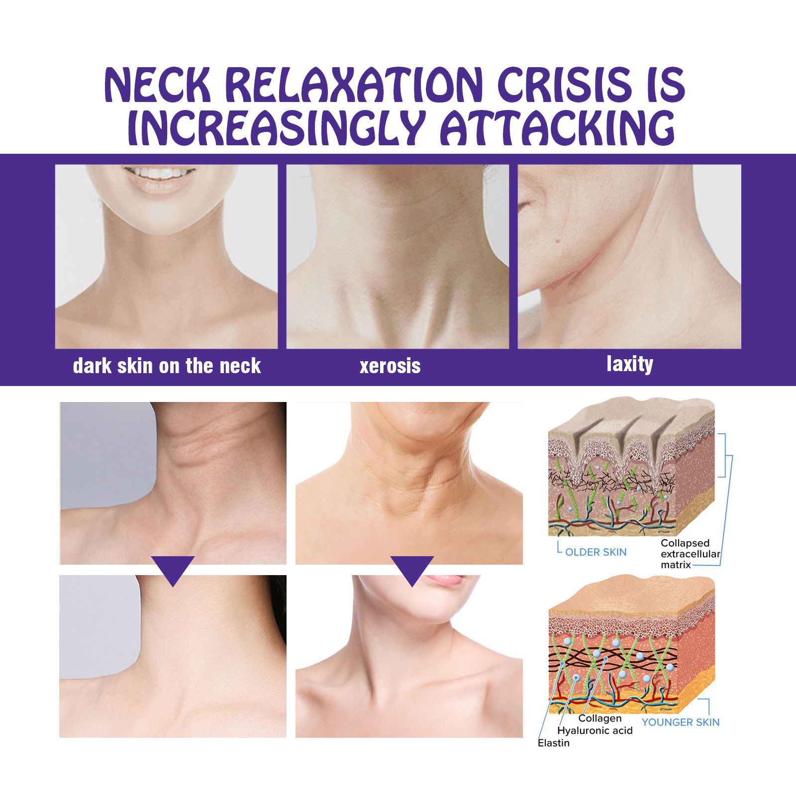 Hoygi Enhancing Firming Hidratante Pescoço, Hidratante, Branqueador, Desbotador, Suavizante e Embelezador do Pescoço Creme_voghion.com