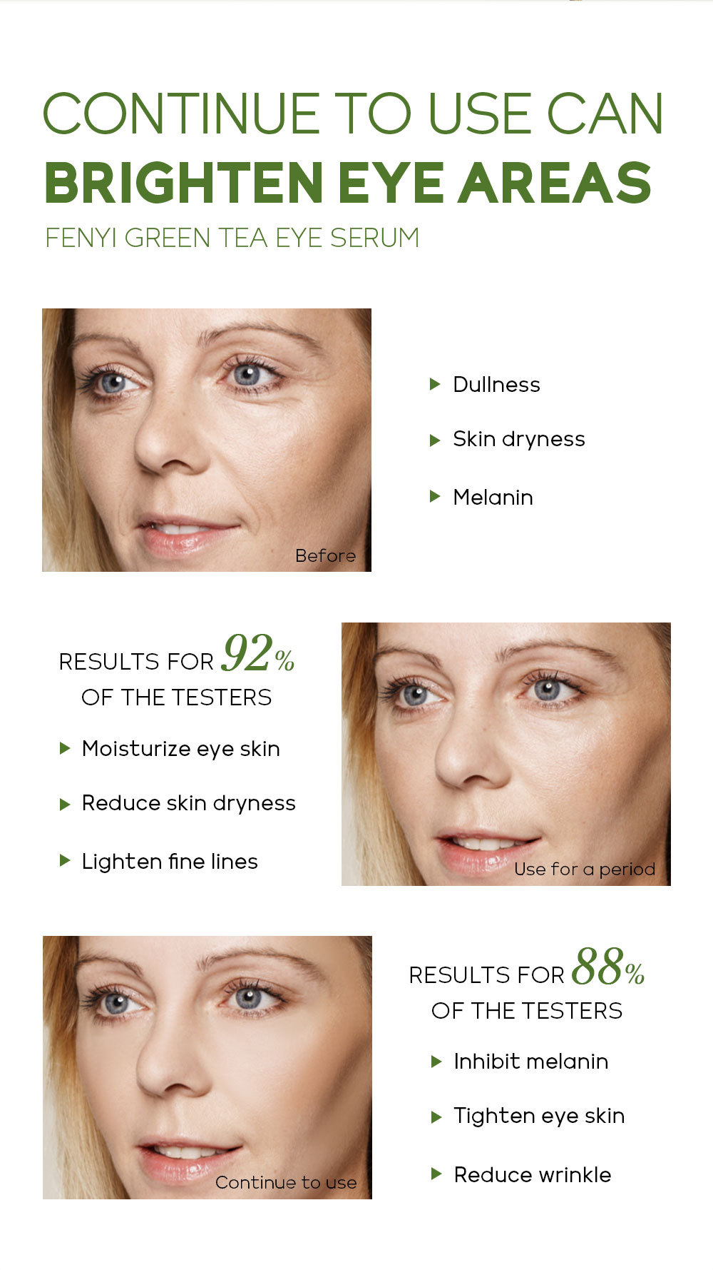 FENYI Green Tea Eye Serum 15ml Hydrates, Moisturizes, cares for and nourishes the skin around the eyes. Cross-border manufacturer undefined