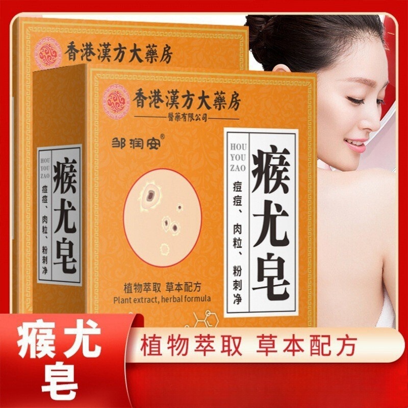 香港薬局の疣贅石鹸は全身に使用でき、痒みを和らげる石鹸、猿の小さな肉粒の洗浄手作り石鹸、卸売在庫あり|undefined