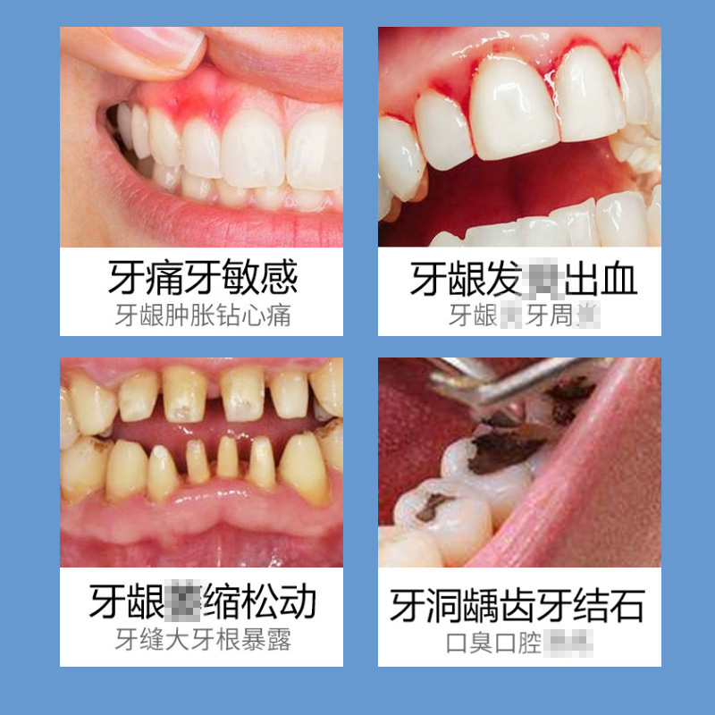 Tooth separation agent, loose teeth, swollen gums, tooth root repair, solid teeth cleaning, fresh breath, yellow toothpaste processing