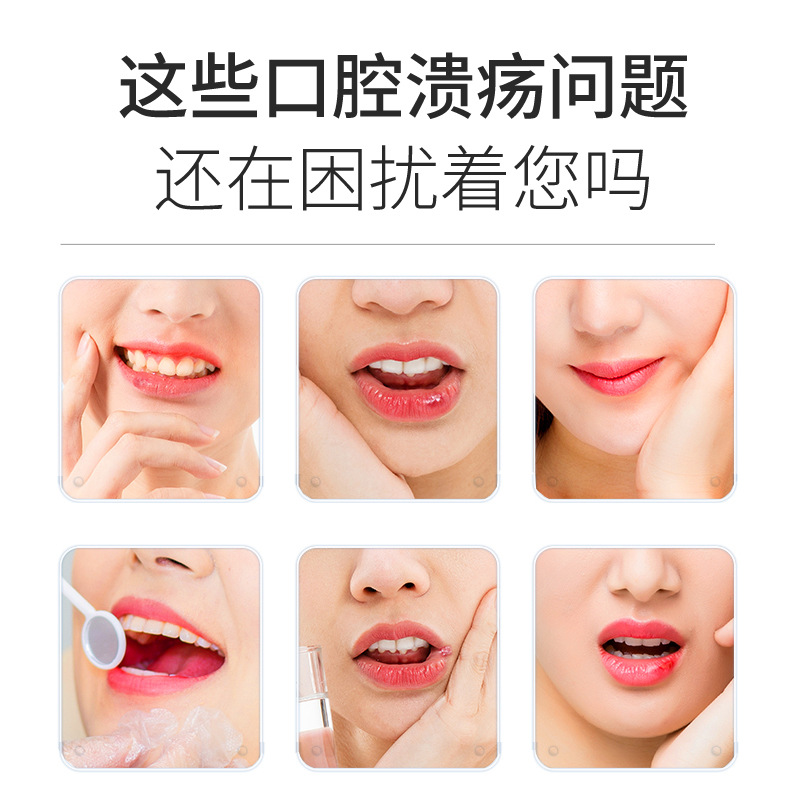 葵花口腔溃疡凝胶缓解止痛口腔疼痛凝胶口腔护理批发代发源头厂家