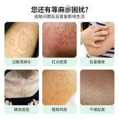 Cerbette Pharma Urtica Cream for External Use Skin Itching Bumps Redness and Swelling Scratches Redness Apply Cream