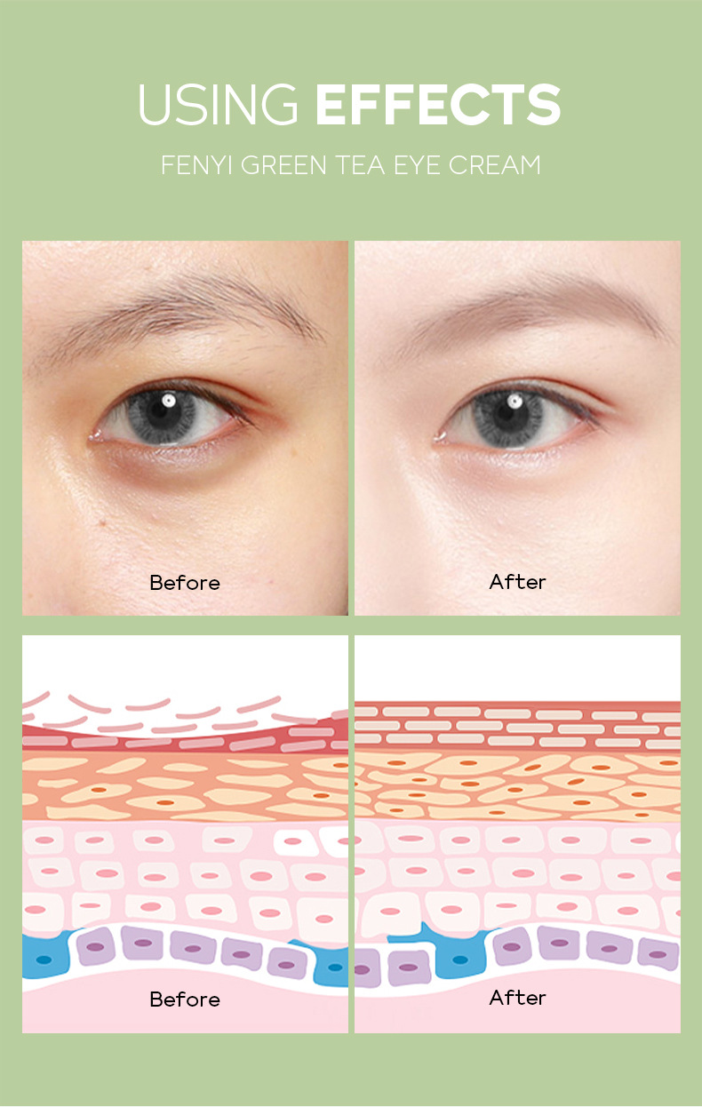 FENYI Green Tea Eye Cream 30g hydrates and moisturizes the eye skin. Cross-border manufacturer wholesale in stock undefined