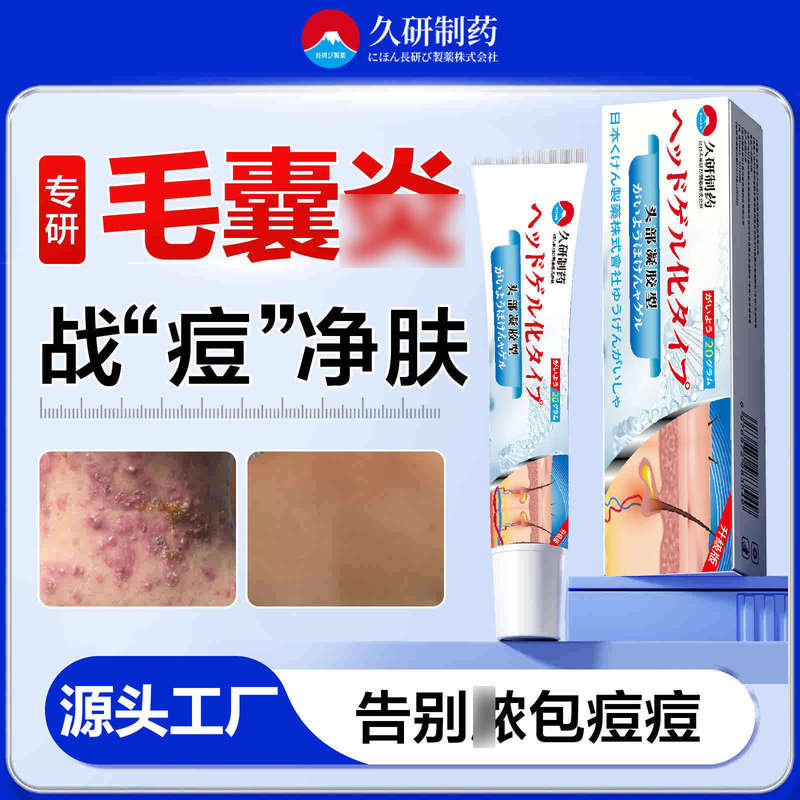 Jiuyan Pharmaceutical マラセチアヘッド毛包軟膏特別な赤いニキビ頭皮かゆみロングヘッドニキビ毛包軟膏|undefined