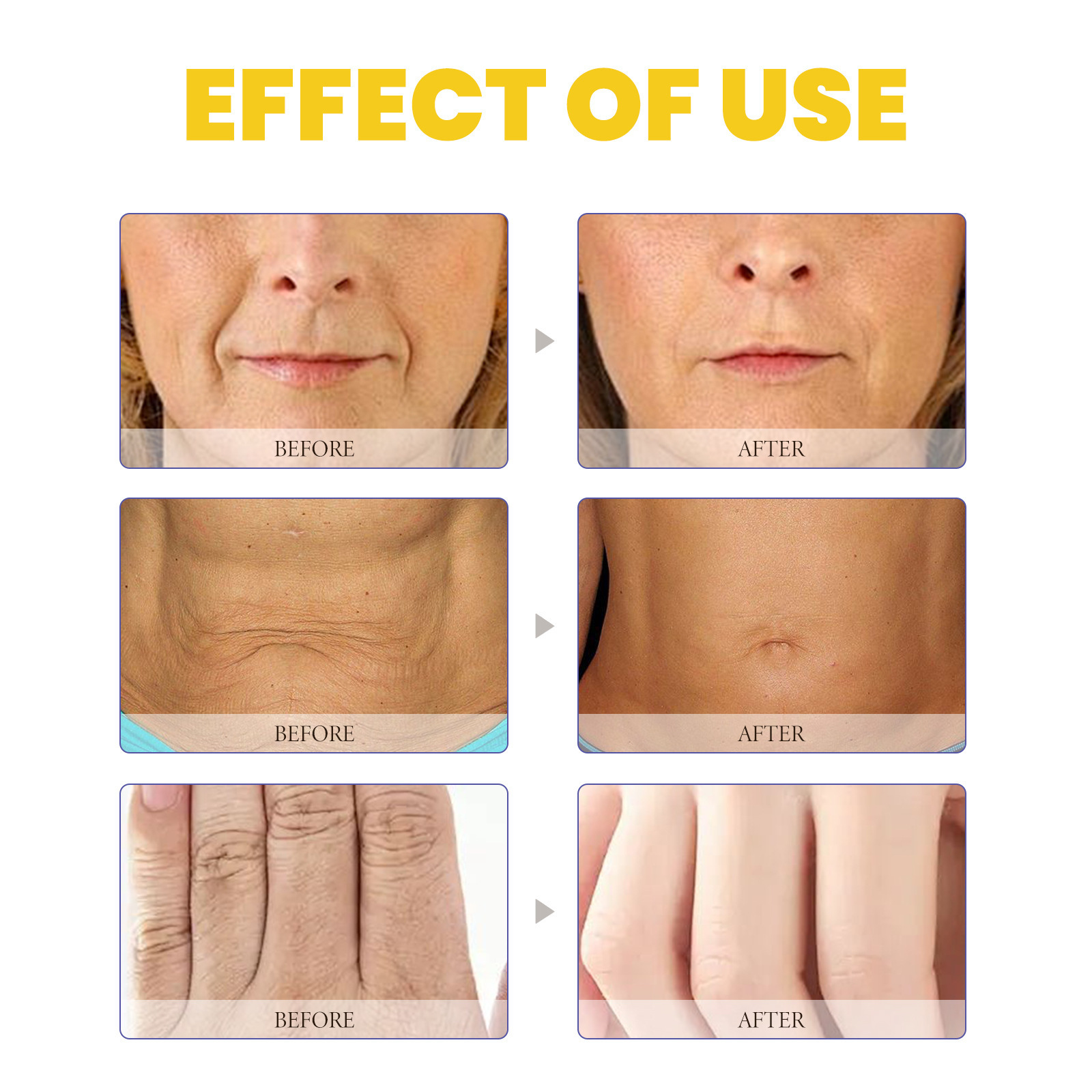 OceanAura Retinol-Creme spendet Feuchtigkeit, nährt, hellt auf und erhellt die Haut. Glatte und Anti-Falten-Körperlotion_voghion.com