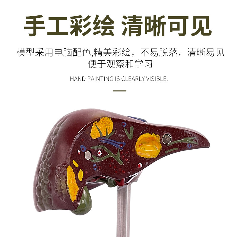 ���ಡ��ģ�� ֬��ģ�� �ε�ģ�� ����� ��������������ģ��