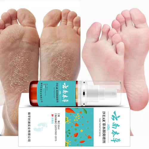 Yibao Yunnan Herbal Foot Antifungal Spray Foot Antifungal Herbal Foot Odor Spray Foot Odor and Sweat Spray