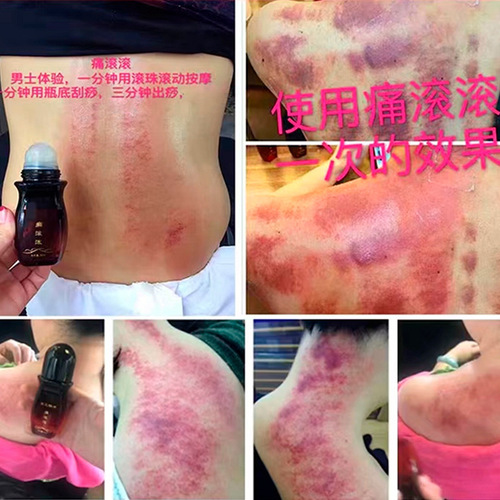 Hot rolling compound essential oil massage essential oil, lumbar spine soothing rolling, joint meridian dredging, heating, fire therapy and scraping