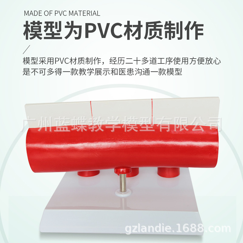 ����Ѫ�ܽ���ģ�� Ѫ��ģ�� ����/Ӳ��չʾ ���׶������Ѫ��չʾ