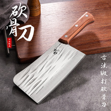 ���Ǹ������^���õ��عǵ����ø��^�ж����������呴����Ϳ��˵�