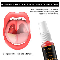 ORALHOE 口腔清潔噴霧 淨味留香噴霧清潔口臭口腔異味清新口氣