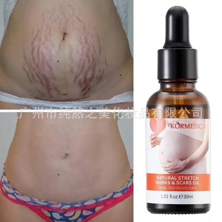 Foreign trade cross-border Stretch Mark Removal Oil desalinization postpartum fine lines fat lines essential oil oe m