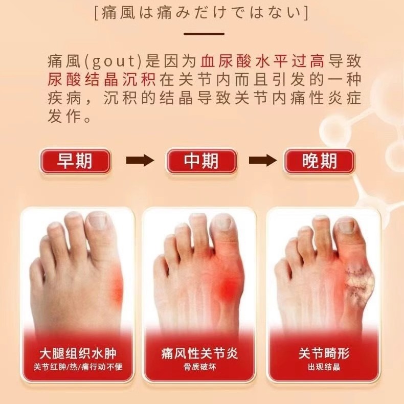 痛风远红外骨痛膏药贴尿酸肿痛关节疼溶缓解疼痛修复官方现货代发|undefined