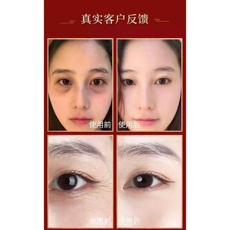 香港大薬局の目のむくみ解消アイパッチ、冷湿布で疲労を和らげ、夜更かしや目の乾燥、かゆみを防ぎ、目を保護します。|undefined