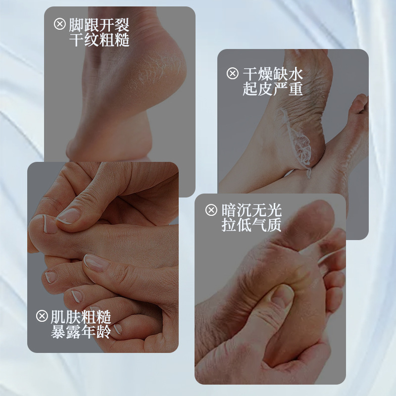 La crema de reparación de pies filipina rejuvenece la piel para hidratar la piel en otoño y invierno, anti-agrietamiento, cuidado suave, mejora la rugosidad, hidratación y suavidad. image 3
