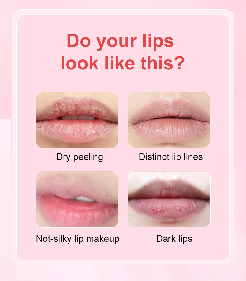 Sleep Lip Mask Image 1