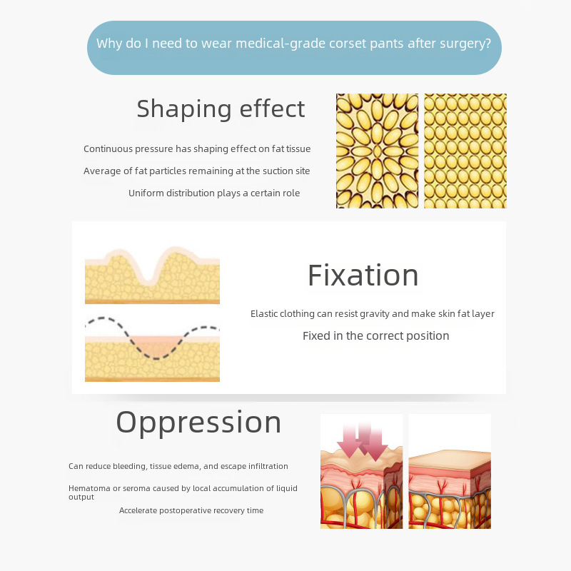 Liposuzione di seconda fase Pantaloni post-modellanti Riparazione post-partum Pantaloni ad alta pressione per il sollevamento dell'anca Addominali con anello grande per polpacci Pantaloni per la modellazione delle gambe_voghion.com
