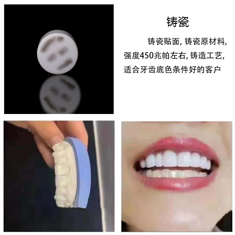 Tiras blanqueadoras de dientes, dientes de porcelana privados, porcelana azul, porcelana ámbar, enseñanza y formación para estudiantes, carillas totalmente cerámicas