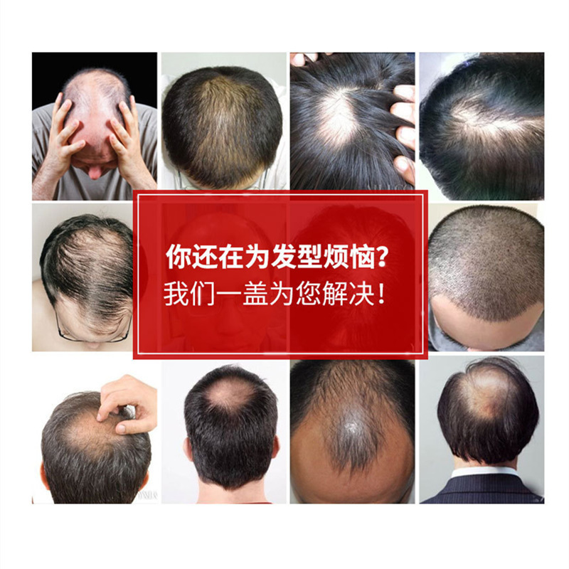 卸売り男性かつらの頭の上で髪の塊がはげている地中海男性の額が自然な髪のかつらを再発行する|undefined