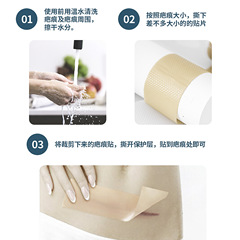 蜜恬芙硅凝膠疤痕貼淡疤貼抑制疤痕增生貼遮疤隱痕疤貼疤痕修復貼